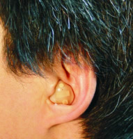 deficiencia auditiva